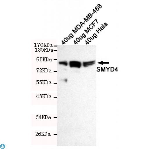 SMYD4 Antibody - Western blot detection of SMYD4 in 40ug Hela, 40ug MCF7 and 40ug MDA-MB-468 cell lysates using SMYD4 mouse mAb (1:100 diluted). Predicted band size: 89KDa. Observed band size: 89KDa.