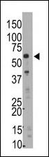SMYD5 Antibody - The anti-Rai15 C-term antibody is used in Western blot to detect Rai15 in mouse liver tissue lysate.