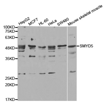 SMYD5 Antibody - Western blot analysis of extracts of various cell lines, using SMYD5 antibody.