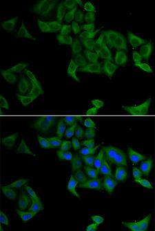 SMYD5 Antibody - Immunofluorescence analysis of A549 cell using SMYD5 antibody. Blue: DAPI for nuclear staining.