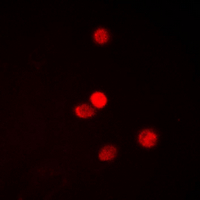 SNAI1 + SNAI2 Antibody - Immunofluorescent analysis of SNAI1/2 (pS246) staining in MDA-MB-231 cells. Formalin-fixed cells were permeabilized with 0.1% Triton X-100 in TBS for 5-10 minutes and blocked with 3% BSA-PBS for 30 minutes at room temperature. Cells were probed with the primary antibody in 3% BSA-PBS and incubated overnight at 4 deg C in a humidified chamber. Cells were washed with PBST and incubated with a DyLight 594-conjugated secondary antibody (red) in PBS at room temperature in the dark. DAPI was used to stain the cell nuclei (blue).