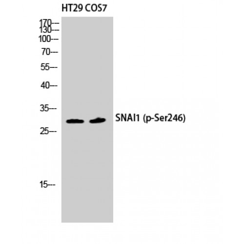 SNAI1 / SNAIL-1 Antibody - Western blot of Phospho-SNAI 1 (S246) antibody