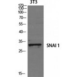 SNAI1 / SNAIL-1 Antibody - Western blot of SNAI 1 antibody