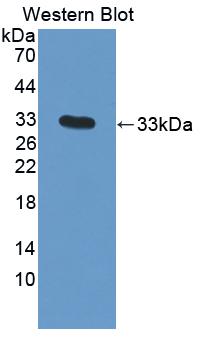 SNAI1 / SNAIL-1 Antibody - Western blot of SNAI1 / SNAIL-1 antibody.