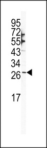 SNAI1 / SNAIL-1 Antibody - Western blot of SNAIL Antibody (N-term R8) in NCI-H460 cell line lysates (35 ug/lane). SNAIL (arrow) was detected using the purified antibody.