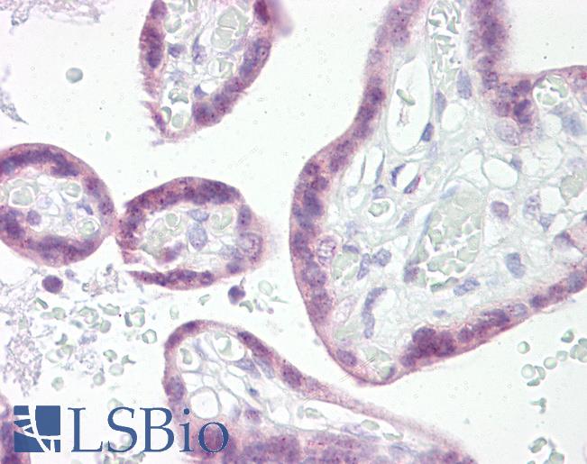SNAI1 / SNAIL-1 Antibody - Human Placenta: Formalin-Fixed, Paraffin-Embedded (FFPE)