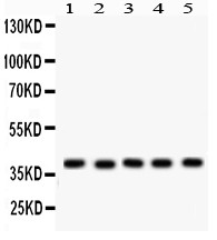 SNAI1 / SNAIL-1 Antibody - SNAIL antibody Western blot. All lanes: Anti SNAIL at 0.5 ug/ml. Lane 1: Rat Cardiac Muscle Tissue Lysate at 50 ug. Lane 2: Rat Skeletal Muscle Tissue Lysate at 50 ug. Lane 3: Mouse Liver Tissue Lysate at 50 ug. Lane 4: MCF-7 Whole Cell Lysate at 40 ug. Lane 5: Human Placenta Tissue Lysate at 50 ug. Predicted band size: 39 kD. Observed band size: 39 kD.