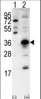 SNAI1 / SNAIL-1 Antibody - Western blot of SNAI1(arrow) using rabbit polyclonal SNAI1 Antibody (N-term D24). 293 cell lysates (2 ug/lane) either nontransfected (Lane 1) or transiently transfected with the SNAI1 gene (Lane 2) (Origene Technologies).