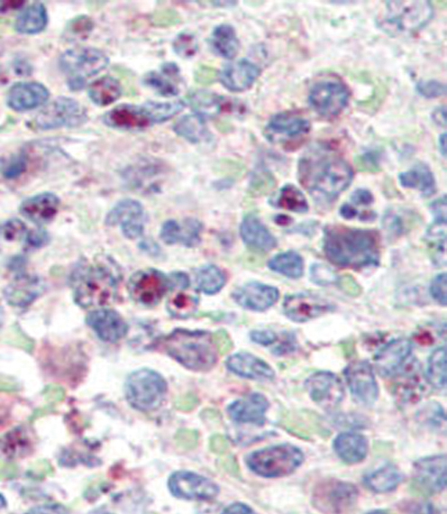 SNAI1 / SNAIL-1 Antibody - Formalin-fixed and paraffin-embedded human Spleen tissue reacted with SNAIL antibody (N-term D24) , which was peroxidase-conjugated to the secondary antibody, followed by AEC staining. This data demonstrates the use of this antibody for immunohistochemistry; clinical relevance has not been evaluated.
