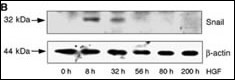 SNAI1 / SNAIL-1 Antibody - HepG2 cells were incubated with HGF for the time periods indicated. LiCl and MG132 were added 8 h before lysis of the cells. Snail protein levels and beta actin as loading control were analyzed by WB.