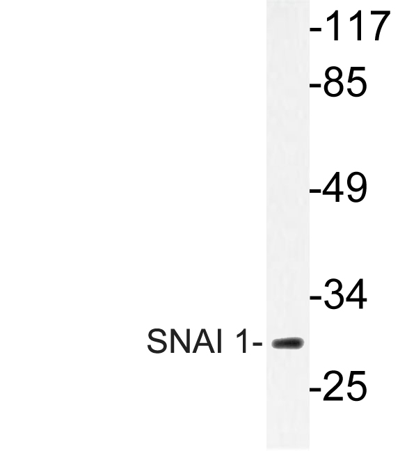 SNAI1 / SNAIL-1 Antibody - Western blot of SNAI 1 (A242) pAb in extracts from HT29 cells.