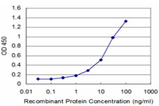 SNAI1 / SNAIL-1 Antibody - Detection limit for recombinant GST tagged SNAI1 is approximately 0.3 ng/ml as a capture antibody.