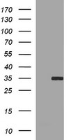 SNAI1 / SNAIL-1 Antibody - HEK293T cells were transfected with the pCMV6-ENTRY control (Left lane) or pCMV6-ENTRY SNAI1 (Right lane) cDNA for 48 hrs and lysed. Equivalent amounts of cell lysates (5 ug per lane) were separated by SDS-PAGE and immunoblotted with anti-SNAI1.