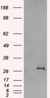 SNAI1 / SNAIL-1 Antibody - HEK293T cells were transfected with the pCMV6-ENTRY control (Left lane) or pCMV6-ENTRY SNAI1 (Right lane) cDNA for 48 hrs and lysed. Equivalent amounts of cell lysates (5 ug per lane) were separated by SDS-PAGE and immunoblotted with anti-SNAI1.