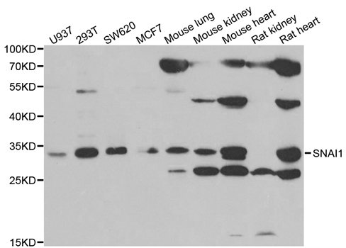 SNAI1 / SNAIL-1 Antibody - Western blot analysis of extracts of various cell lines, using Snail antibody.