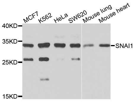 SNAI1 / SNAIL-1 Antibody - Western blot analysis of extracts of various cells.