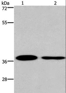 SNAI1 / SNAIL-1 Antibody - Western blot analysis of 293T and A549 cell, using SNAI1 Polyclonal Antibody at dilution of 1:200.