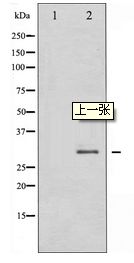 SNAI1 / SNAIL-1 Antibody - Western blot of SNAI1 expression in HT29 whole cell lysates,The lane on the left is treated with the antigen-specific peptide.