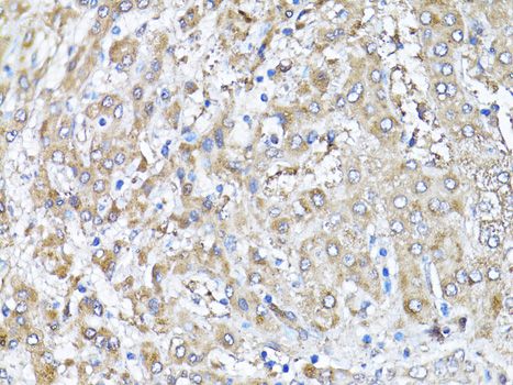 SNAI1 / SNAIL-1 Antibody - Immunohistochemistry of paraffin-embedded human liver using SNAI1 antibody at dilution of 1:100 (40x lens).