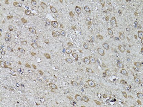 SNAI1 / SNAIL-1 Antibody - Immunohistochemistry of paraffin-embedded mouse brain using SNAI1 antibody at dilution of 1:100 (40x lens).