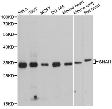 SNAI1 / SNAIL-1 Antibody - Western blot analysis of extracts of various cell lines, using SNAI1 antibody at 1:1000 dilution. The secondary antibody used was an HRP Goat Anti-Rabbit IgG (H+L) at 1:10000 dilution. Lysates were loaded 25ug per lane and 3% nonfat dry milk in TBST was used for blocking. An ECL Kit was used for detection and the exposure time was 60s.