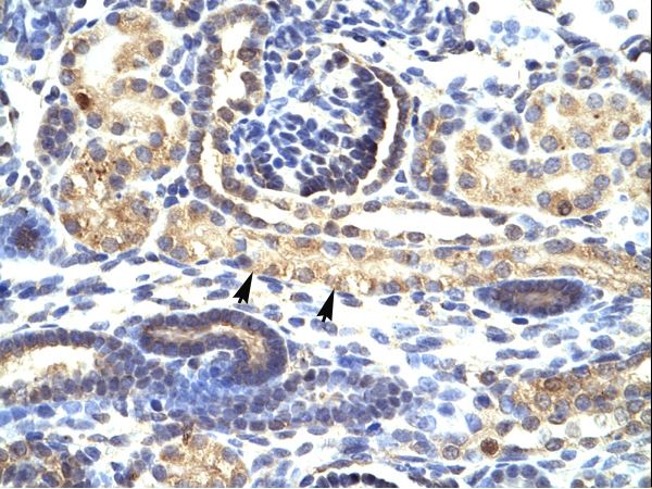 SNAI1 / SNAIL-1 Antibody - SNAI1 / SNAIL antibody ARP33314_P050-NP_005976-SNAI1 (snail homolog 1 (Drosophila)) Antibody was used in IHC to stain formalin-fixed, paraffin-embedded human kidney.  This image was taken for the unconjugated form of this product. Other forms have not been tested.