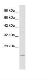 SNAI1 / SNAIL-1 Antibody - Jurkat Cell Lysate.  This image was taken for the unconjugated form of this product. Other forms have not been tested.