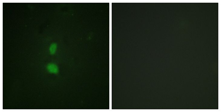 SNAI1 / SNAIL-1 Antibody - Immunofluorescence analysis of HUVEC cells, using SNAI1 (Phospho-Ser246) Antibody. The picture on the right is blocked with the phospho peptide.