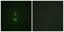 SNAI1 / SNAIL-1 Antibody - Immunofluorescence analysis of HUVEC cells, using SNAI1 (Phospho-Ser246) Antibody. The picture on the right is blocked with the phospho peptide.