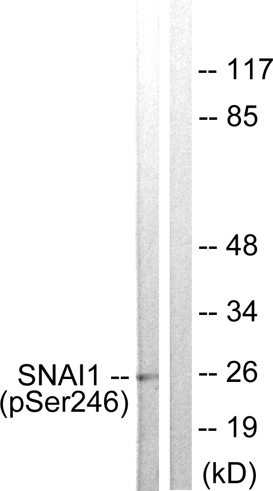 SNAI1 / SNAIL-1 Antibody - Western blot analysis of lysates from HT29 cells, using SNAI1 (Phospho-Ser246) Antibody. The lane on the right is blocked with the phospho peptide.