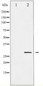 SNAI1 / SNAIL-1 Antibody - Western blot of SNAI1 phosphorylation expression in HT29 whole cell lysates,The lane on the left is treated with the antigen-specific peptide.