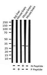 SNAI1 / SNAIL-1 Antibody - Western blot analysis of Phospho-SNAI1 (Ser246) expression in various lysates