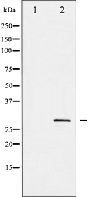 SNAI1 / SNAIL-1 Antibody - Western blot analysis of SNAI1 phosphorylation expression in HT29 whole cells lysates. The lane on the left is treated with the antigen-specific peptide.