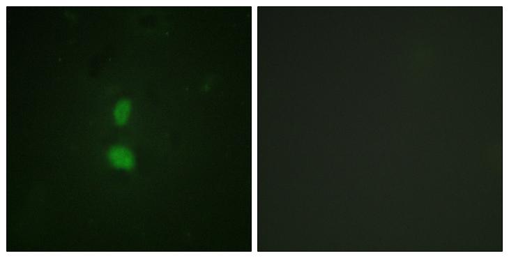 SNAI1 / SNAIL-1 Antibody - P-peptide - + Immunofluorescence analysis of HuvEc cells, using SNAI1 (Phospho-Ser246) antibody.