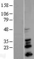SNAI1 / SNAIL-1 Protein - Western validation with an anti-DDK antibody * L: Control HEK293 lysate R: Over-expression lysate