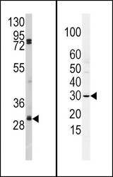 SNAI2 / SLUG Antibody - (LEFT)Western blot of anti-SLUG Antibody (N-term K9) antibody in A2058 cell line lysates (35 ug/lane). SLUG(arrow) was detected using the purified antibody.(RIGHT)Western blot of SLUG Antibody (N-term K9) in HCSMC cell line lysates (35 ug/lane). SLUG (arrow) was detected using the purified antibody.