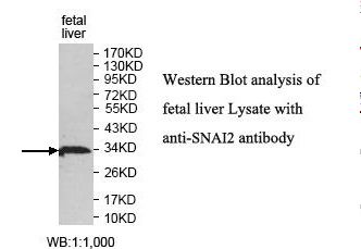 SNAI2 / SLUG Antibody