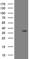 SNAI2 / SLUG Antibody - HEK293T cells were transfected with the pCMV6-ENTRY control (Left lane) or pCMV6-ENTRY SNAI2 (Right lane) cDNA for 48 hrs and lysed. Equivalent amounts of cell lysates (5 ug per lane) were separated by SDS-PAGE and immunoblotted with anti-SNAI2.