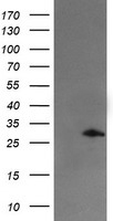 SNAI2 / SLUG Antibody - HEK293T cells were transfected with the pCMV6-ENTRY control (Left lane) or pCMV6-ENTRY SNAI2 (Right lane) cDNA for 48 hrs and lysed. Equivalent amounts of cell lysates (5 ug per lane) were separated by SDS-PAGE and immunoblotted with anti-SNAI2.