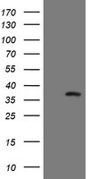 SNAI2 / SLUG Antibody - HEK293T cells were transfected with the pCMV6-ENTRY control (Left lane) or pCMV6-ENTRY SNAI2 (Right lane) cDNA for 48 hrs and lysed. Equivalent amounts of cell lysates (5 ug per lane) were separated by SDS-PAGE and immunoblotted with anti-SNAI2.