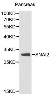 SNAI2 / SLUG Antibody - Western blot of SNAI2 pAb in extracts from mouse pancreas tissue.
