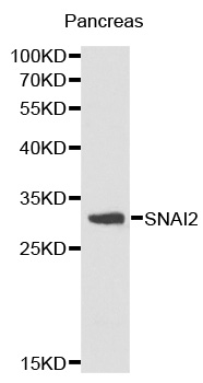 SNAI2 / SLUG Antibody - Western blot analysis of pancreas cell lysate.