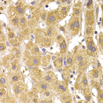 SNAI2 / SLUG Antibody - Immunohistochemistry of paraffin-embedded Human liver injury tissue.