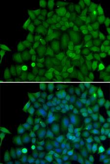 SNAI2 / SLUG Antibody - Immunofluorescence analysis of MCF7 cells.