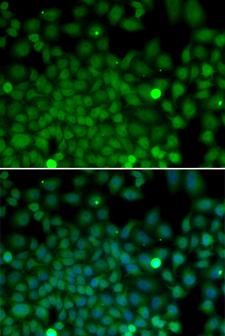 SNAI2 / SLUG Antibody - Immunofluorescence analysis of U2OS cells.