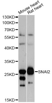 SNAI2 / SLUG Antibody - Western blot analysis of extracts of various cell lines, using SNAI2 antibody at 1:1000 dilution. The secondary antibody used was an HRP Goat Anti-Rabbit IgG (H+L) at 1:10000 dilution. Lysates were loaded 25ug per lane and 3% nonfat dry milk in TBST was used for blocking. An ECL Kit was used for detection and the exposure time was 60s.