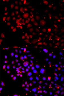 SNAI2 / SLUG Antibody - Immunofluorescence analysis of A549 cells using SNAI2 antibody. Blue: DAPI for nuclear staining.