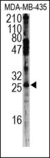 SNAI2 / SLUG Antibody - The SLUG Antibody is used in Western blot to detect SLUG in MDA-MB-435 cell lysate.