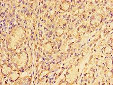 SNAI2 / SLUG Antibody - Immunohistochemistry of paraffin-embedded human gastric tissue using SNAI2 Antibody at dilution of 1:100