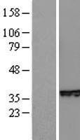 SNAI2 / SLUG Protein - Western validation with an anti-DDK antibody * L: Control HEK293 lysate R: Over-expression lysate